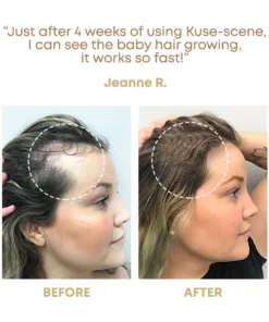 Kuse-Scene RiceWater Hair SerumMist