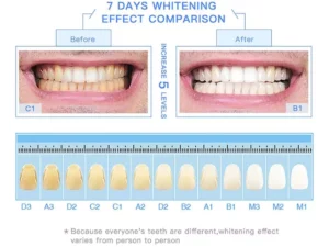 LAFEIGE™ Teeth Whitening Tooth Essence