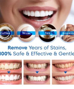 LANTHOME™ Teeth Whitening Essence