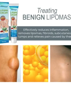 LUMPFree Herbal LipomaRemoval Cream