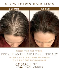 LUODAS Hair'GRO Serum