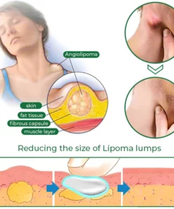 LipomaCure™ Soothing Ointment