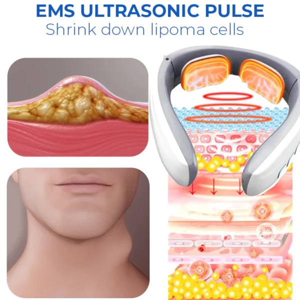 LipomaOut™ Neck EMS Ultrasone Massager