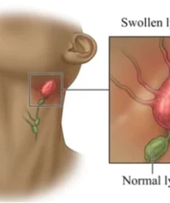 Lymph Detoxification Ginger Oil