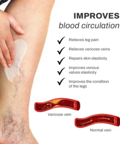 LymphCare VaricoseVeins Treatment Cream