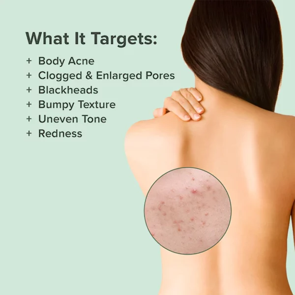 Medix ™ Back Acne Treatment Spray