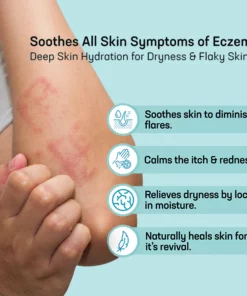MEDix™ Eczema Treatment Spray