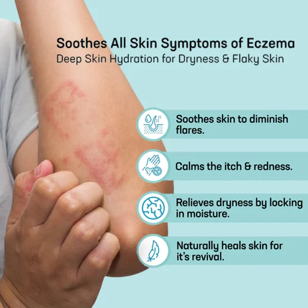 MEDix™ Eczema Treatment Spray
