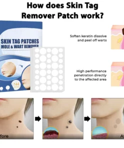 MaxPerformance Skin Tag Remover Patch