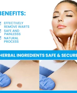 MaxPerformance WartClearPLUS Instant Wart Removal Ointment