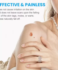 MaxPerformance WartClearPLUS Instant Wart Removal Ointment