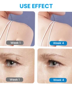 MaxPerformance WartClearPLUS Instant Wart Removal Ointment