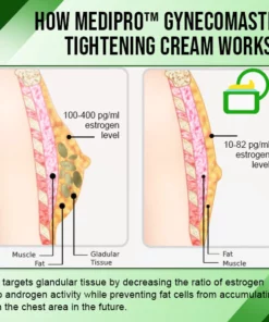 MediPRO™ Gynecomastia Tightening Cream