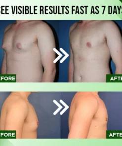 MediPRO™ Gynecomastia Tightening Cream