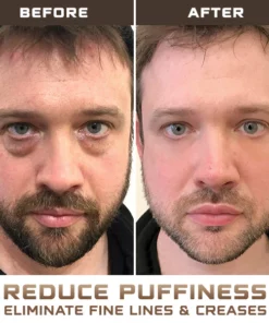 Men'Expert Hydra Energetic Eye Roller