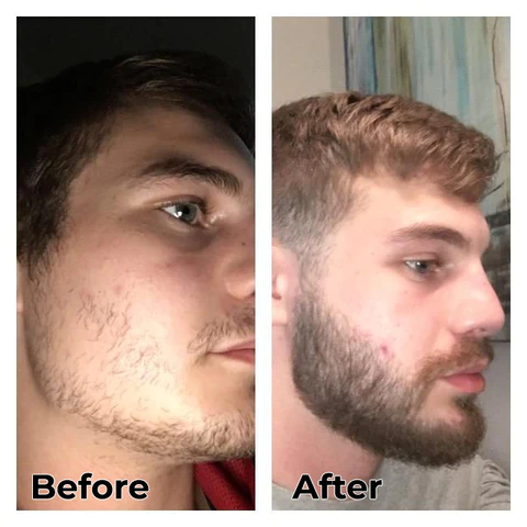 Mens Beard Hair Growth Spray