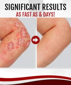 Mory Silk Goat Milk Essence Soap