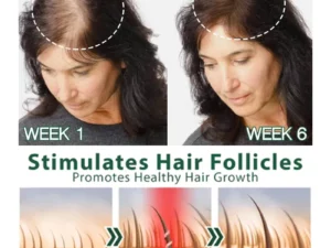 OUAL™ Follicle Nourishing HairGrowth Serum