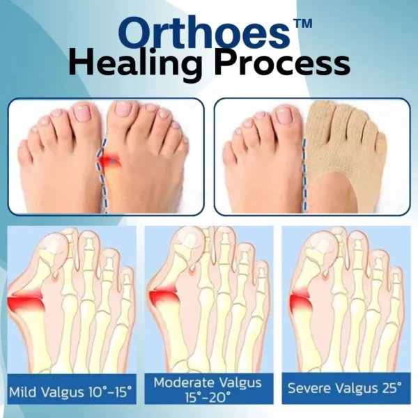 Orthoes™ Bunion Relief Sokker