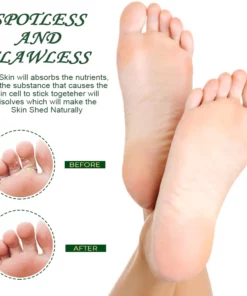 PediPro CornRemoval StrengthenGel