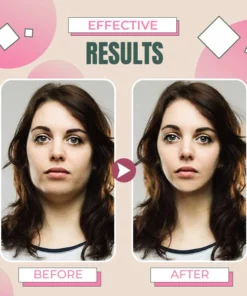 PokeSlim MicroCurrent Acupoints Therapeutic Massager