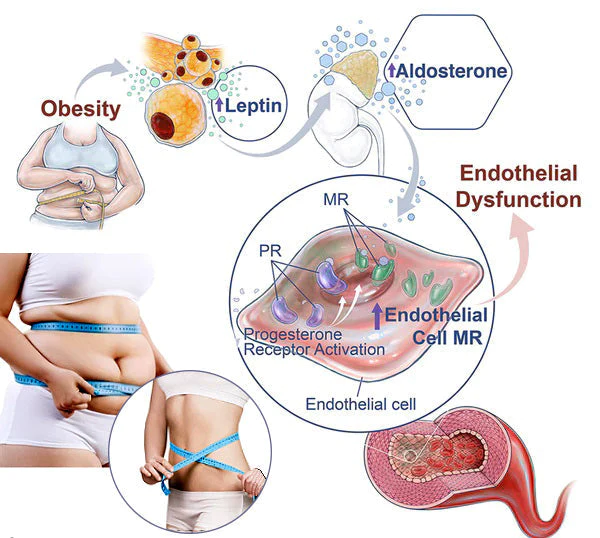 PrettyHealth™ Lymphvity детоксикация и оформяне и мощен повдигащ сутиен