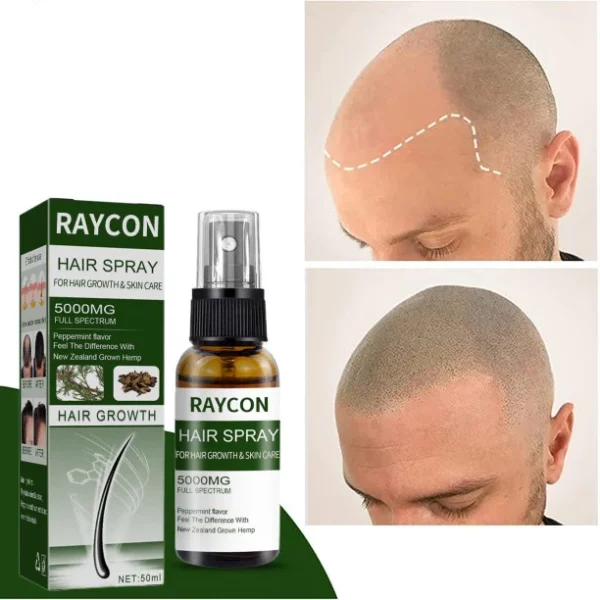 Vitalizzatore per la crescita dei capelli RAYCON ™