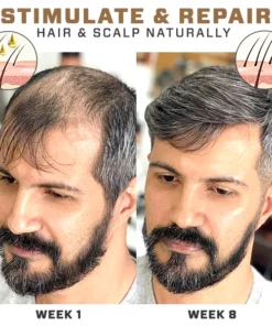 Re'awaken Hair&Beard Serum Spray