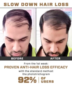 Re'awaken Hair&Beard Serum Spray