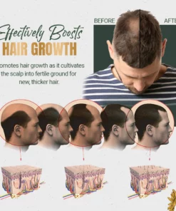 Red Ginseng HairRe-Generation Spray