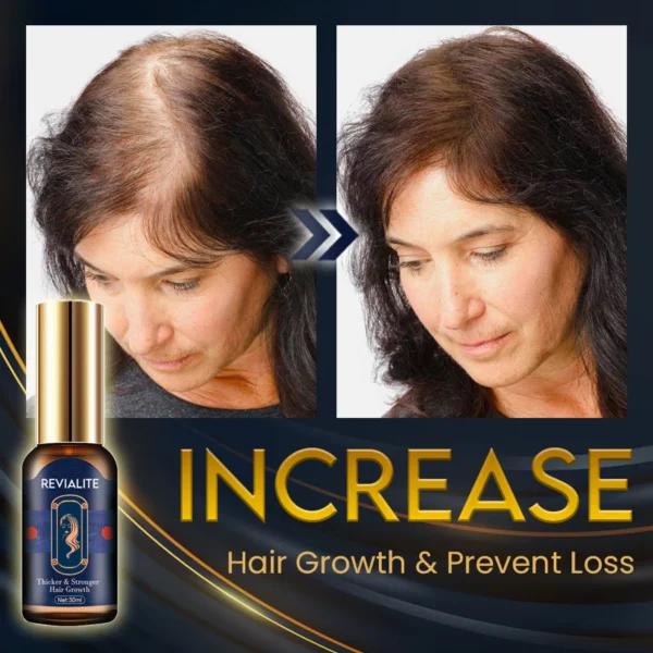 Revialite Hair Regrowth Serum