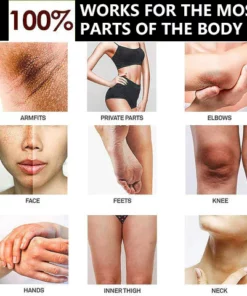 SKINSEED™ Dark Spot And Acne Treatment Serum Serum