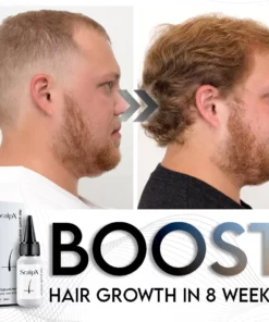ScalpX Hair Growth Essence