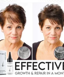 ScalpX Hair Growth Essence