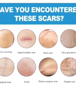 Scarfastoff Instant Scar Repair Cream