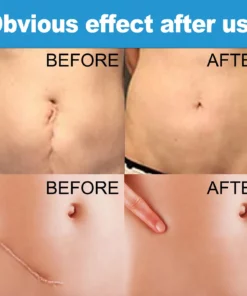 Scarfastoff Instant Scar Repair Cream