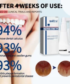 ShinTeeth® Calculus Dissolving Powerful Oral Spray