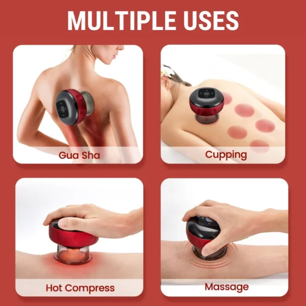Shirln ™ Electric Cupping Massager