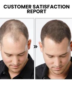 ShougaGRO Japanese Hair Growth Spray