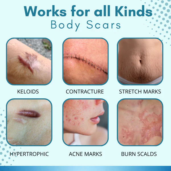 SkinFx™ Scar & Acne Bump Removal Cream