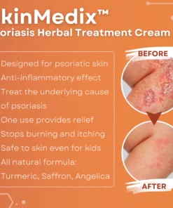 SkinMedix™ Psoriasis Herbal Treatment Cream