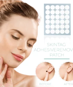 SkinReborn™ SkinTag AdhesiveRemover Patch