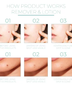 SkinReborn™ SkinTag AdhesiveRemover Patch