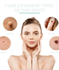 SkinReborn™ SkinTag AdhesiveRemover Patch