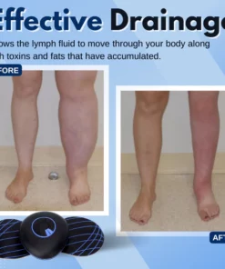 SlimTech™ Lymph-Drainage Leg Massager