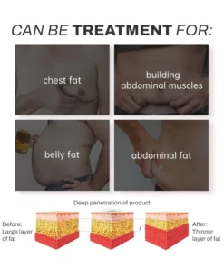 SouthMoon Chili Herbal SlimmingCream