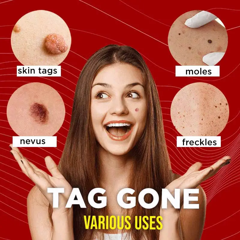 TagGone™ प्राकृतिक ट्याग सीरम