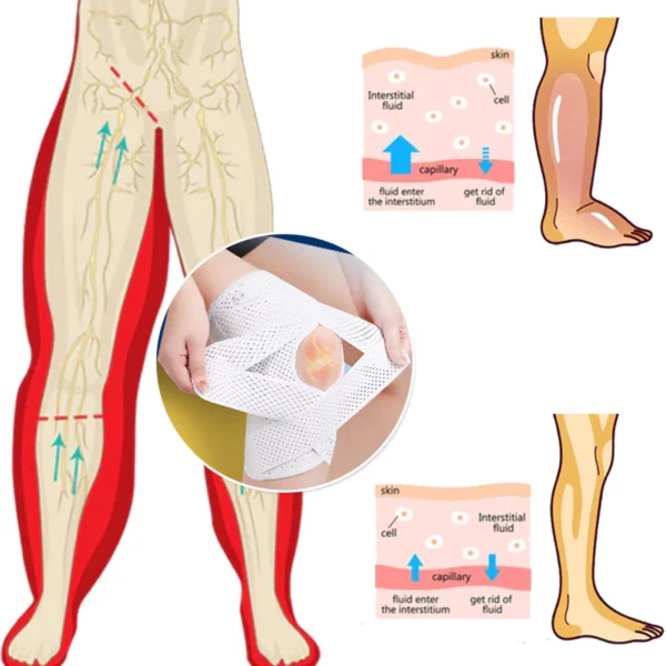 TrawDex™ AntiEdema Compression Strap