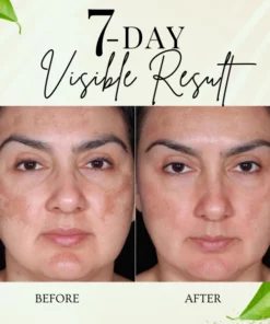 Turmeric Dark Spot Corrector Serum