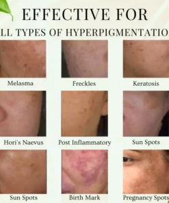 Turmeric Dark Spot Corrector Serum